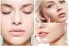 Dermalax HA Hyaluronic Acid  Dermal Fillers 1 ml For lip augmentation injections and superficial wrinkle removal